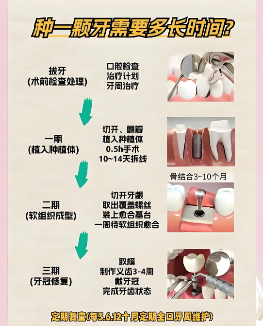 绍兴种植牙医院如何选