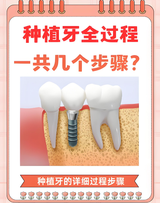 绍兴种植牙医院排名前十www.59w.net