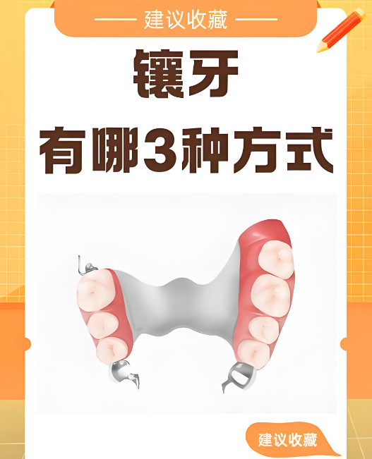 温州镶牙医院哪家好？前十排名榜单出炉，从300元平价到3万高端全解析！