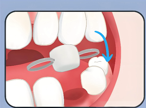 温州活动义齿价格www.59w.net