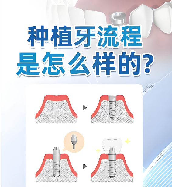 关呈超种牙实例www.59w.net