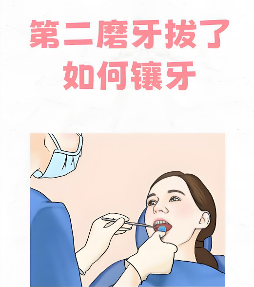 宁波镶牙医院哪家好