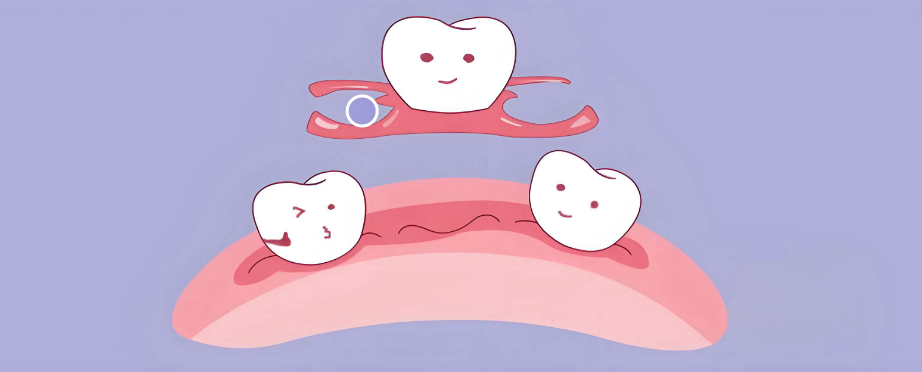 杭州镶牙医院哪家好