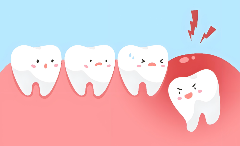 杭州镶牙如何选