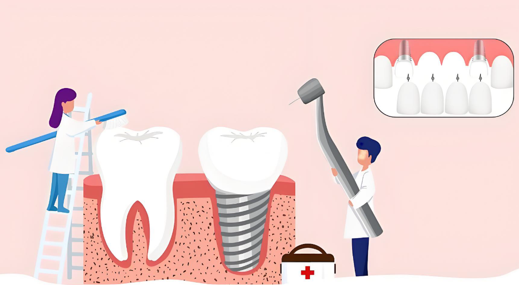 丽水种植牙手术怎么样