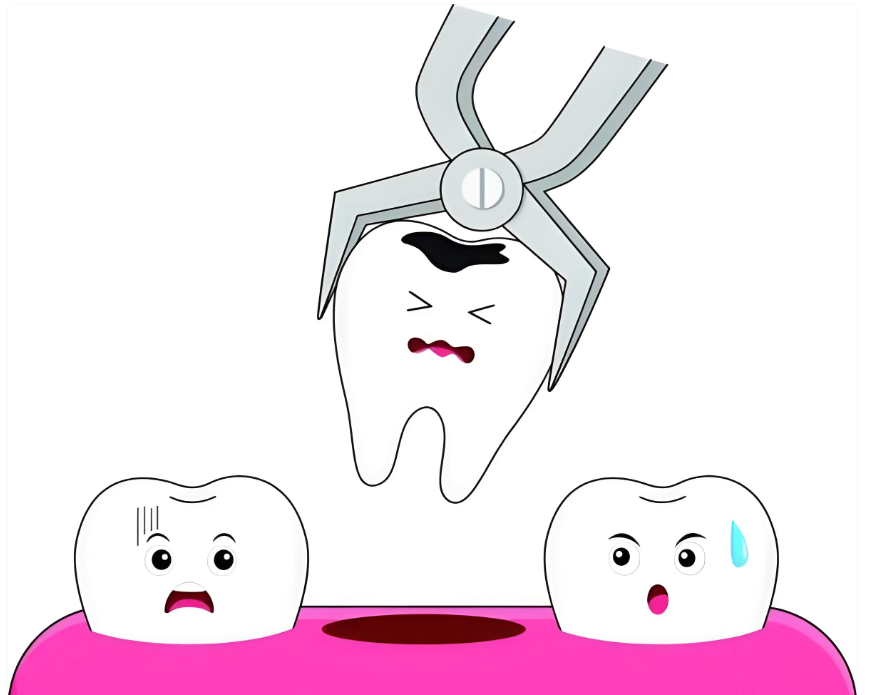 宁波拔智齿价格