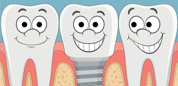 北京石景山哪里种植牙靠谱www.59w.net