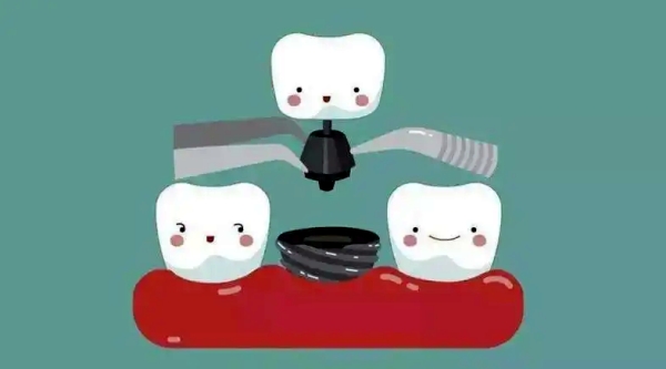 北京石景山哪里种植牙靠谱?首口附一、中胜、爵冠口腔种牙性价比高受患者好评