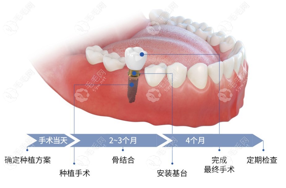 太仓贝莱德口腔优势 太仓贝莱德口腔优势