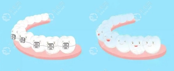王会医生矫正牙齿技术优势 王会医生矫正牙齿技术优势