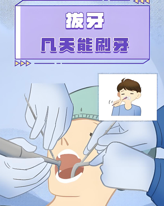 宁波拔牙哪个医院比较好?推荐排名前十的口腔机构,医生手法稳,我的牙根带弯也只用了十分钟