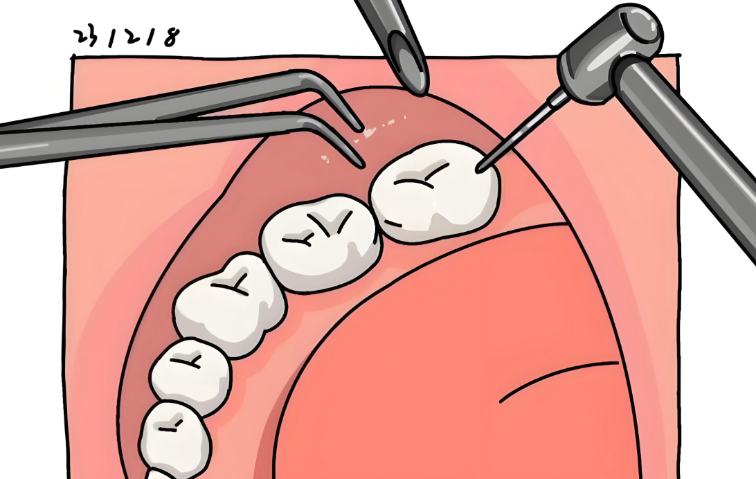 宁波拔牙哪个医院比较好