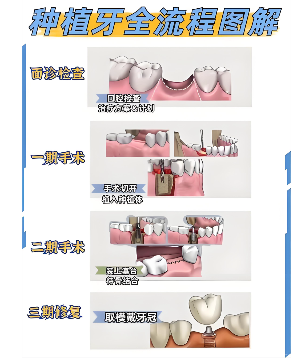 嘉兴种植牙医院排名前十
