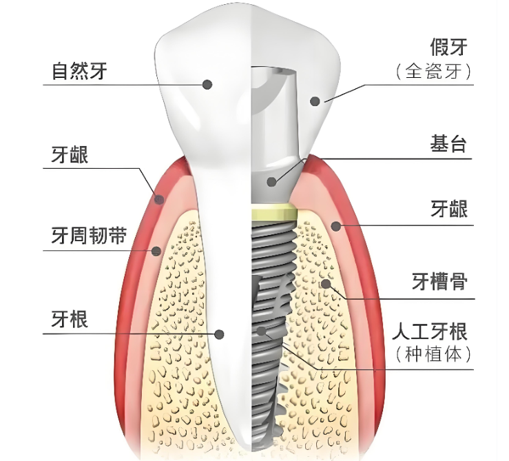 嘉兴种植牙医院哪家好