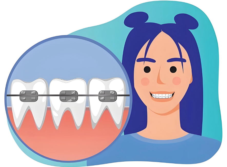 金华牙齿矫正费用标准