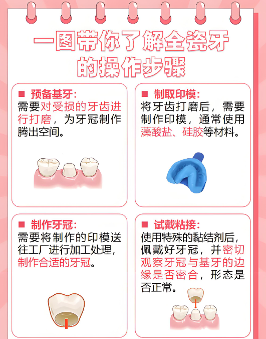 全瓷牙套5年后反馈