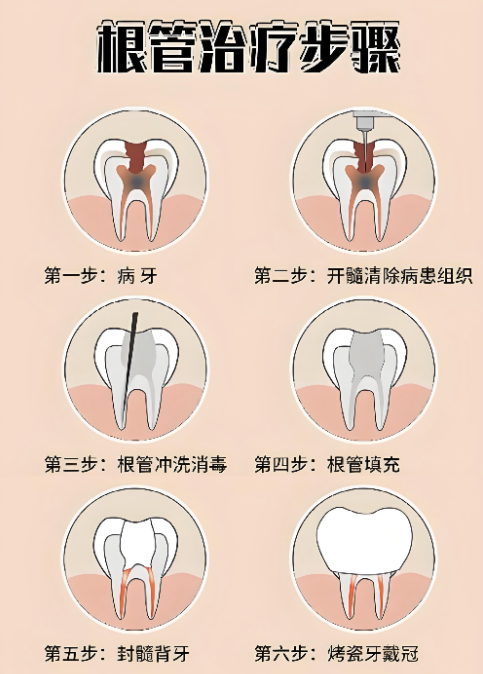 温州根管治疗哪家医院比较好？避免二次受罪！在温州做根管治疗，一定要找有显微根管设备的医院！