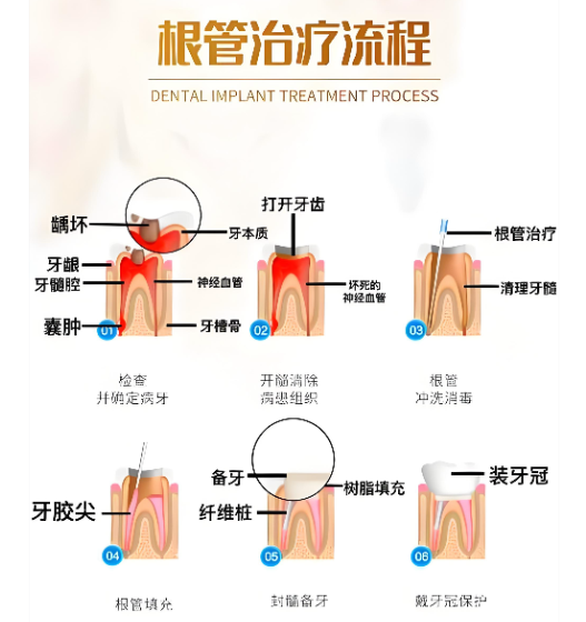 温州根管治疗医院排名前十