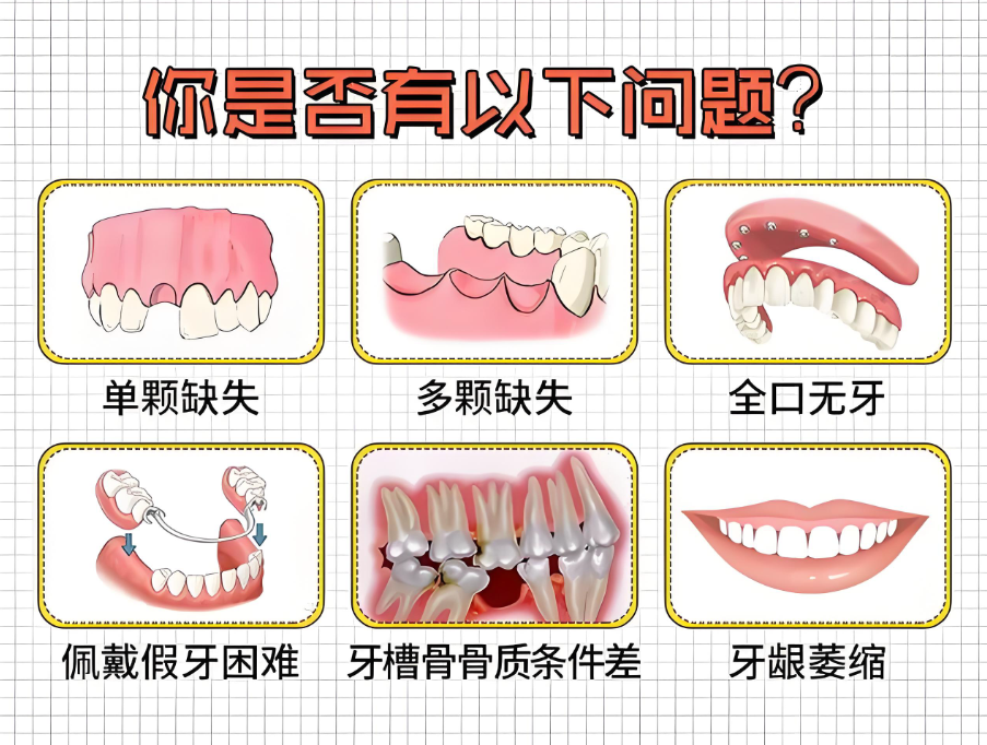 温州俪宣口腔种植牙好不好www.59w.net