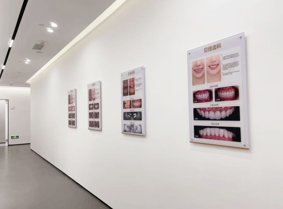 杭州贝佳齿科收费全揭秘：从1495元种植牙到4.9万隐适美，这份价目表让你不花冤枉钱！