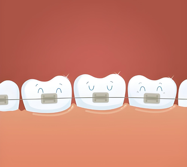 温州戴牙套哪家医院好