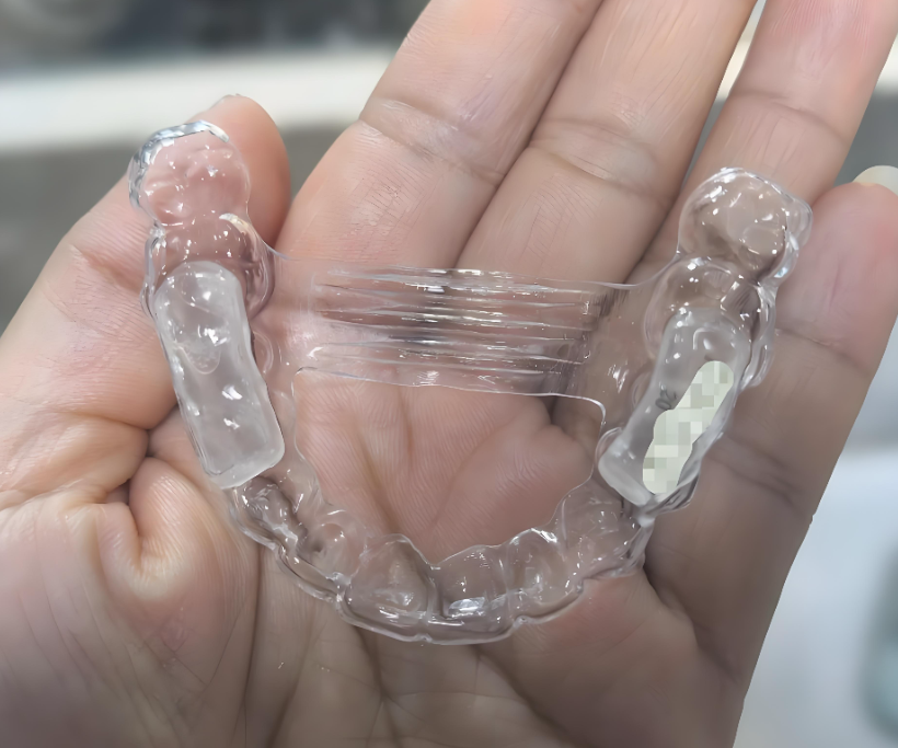 温州戴牙套医院如何选www.59w.net