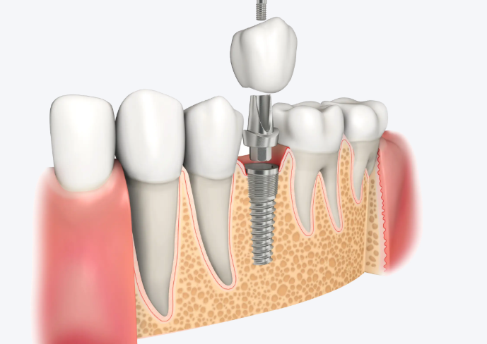重庆泰颌口腔大石坝店项目介绍