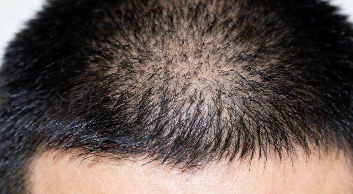 给发友 3 点真心话