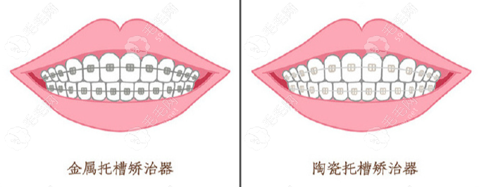 重庆皓牙口腔诊所执业医师吴尽
