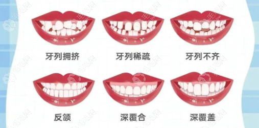 矫正不同适合人群