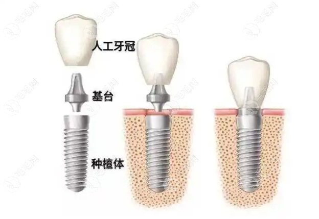 技术与的治疗方案