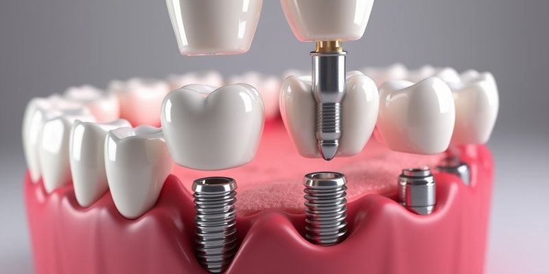 二、威士达福种植体的技术优势