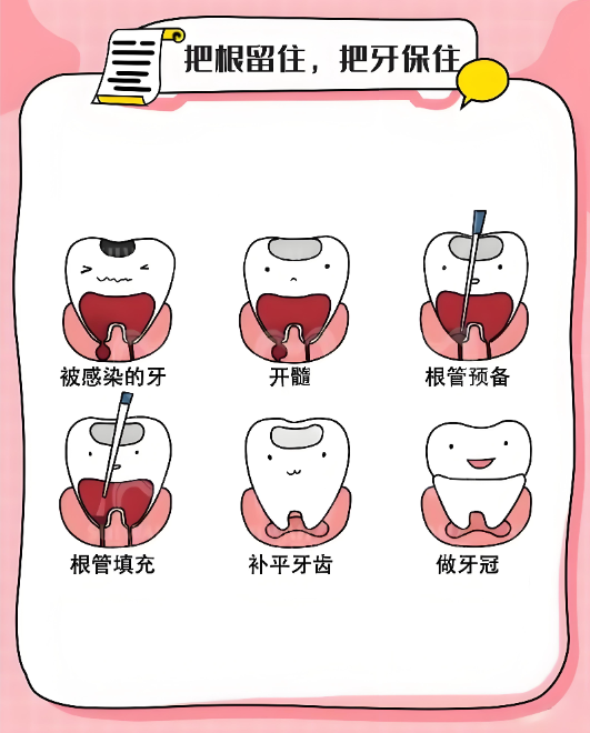 兴根管治疗医院排名前十名单
