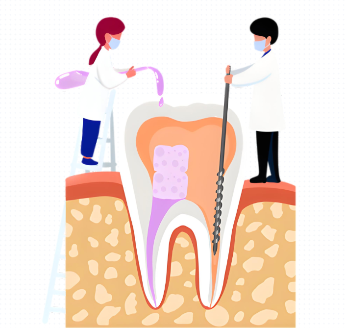 绍兴根管治疗医院哪家好