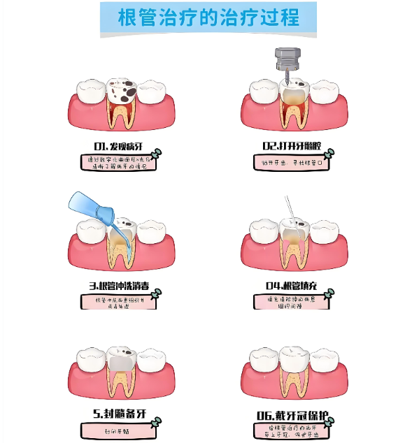 绍兴根管治疗医院如何选www.59w.net