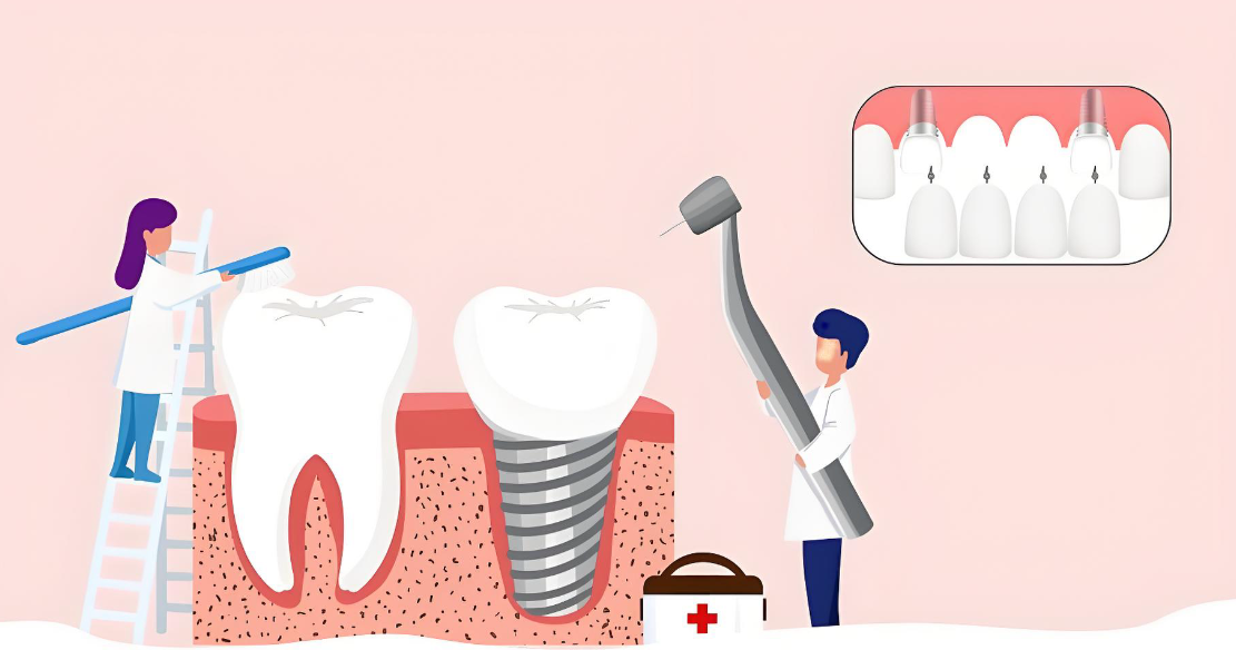 杭州杭嘉口腔浦沿店种牙技术怎么样