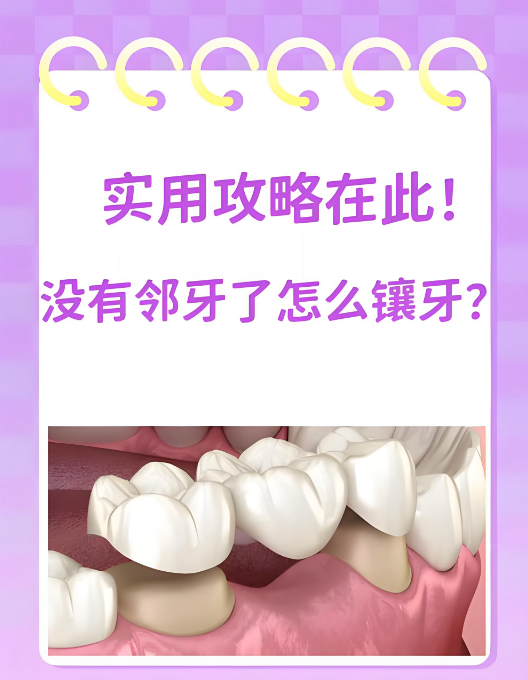 舟山镶牙医院如何选www.59w.net