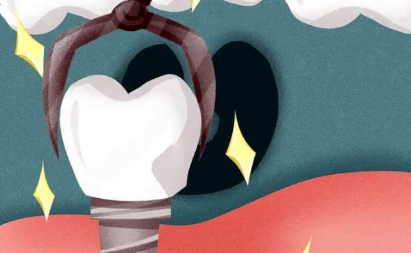 大清西格种植体适用人群