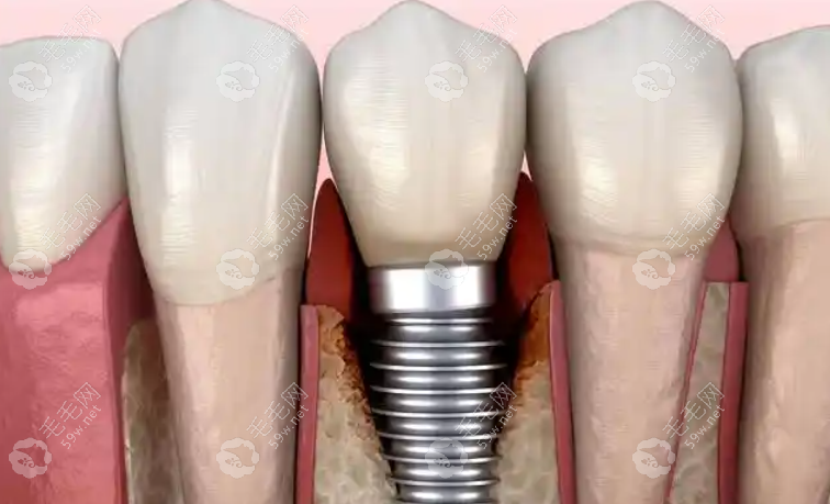 重庆万州欧菲雅口腔门诊部执业医师梅时友