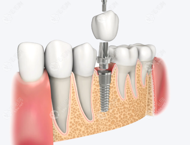 积淀，技术为本