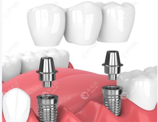 仁心服务，患者为先