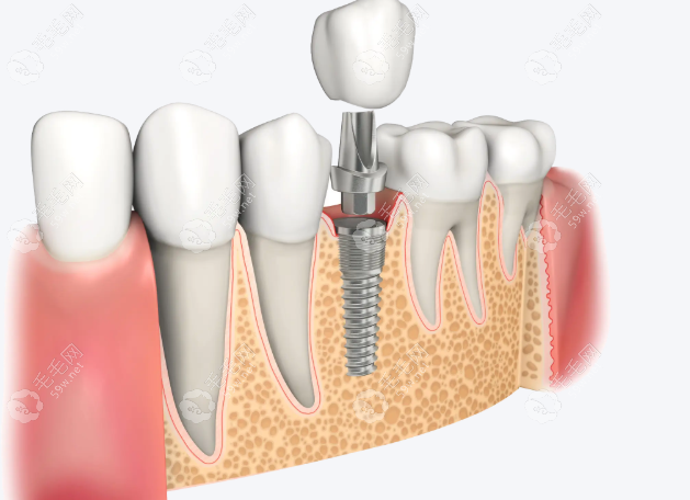 重庆忠县渝状元口腔种植牙医生许国卿简 重庆忠县渝状元口腔种植牙医生许国卿简