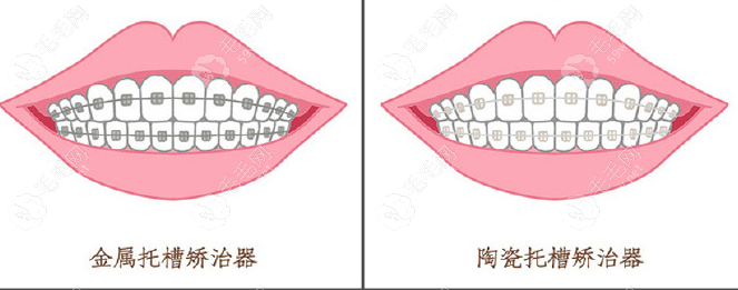 重庆忠县渝状元口腔门诊部执业医师毛锡莉