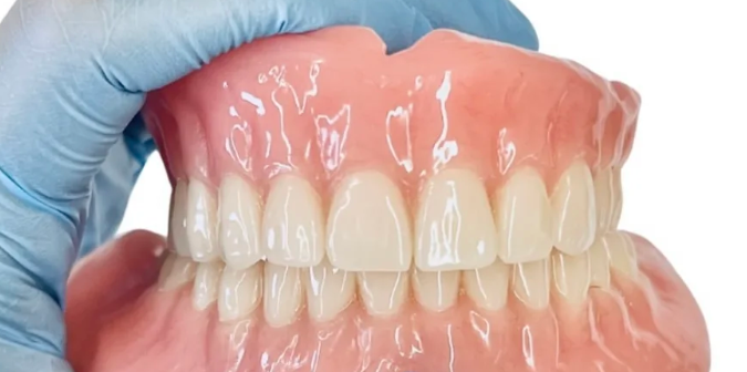 马里兰桥和活动义齿哪个更牢固？活动义齿
