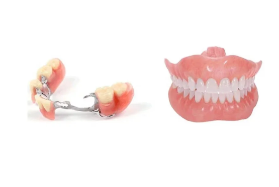 马里兰桥和活动义齿哪个更牢固？实例说明