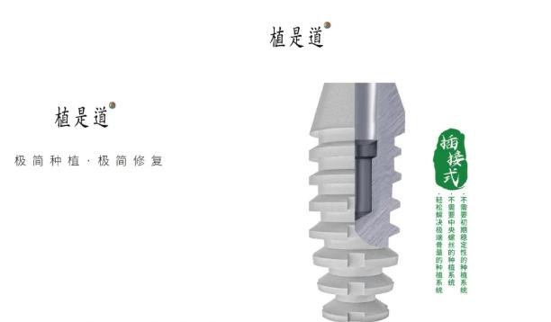 植是道种植体三种档次价格别乱选,低中高挡适合人群和费用差要搞懂