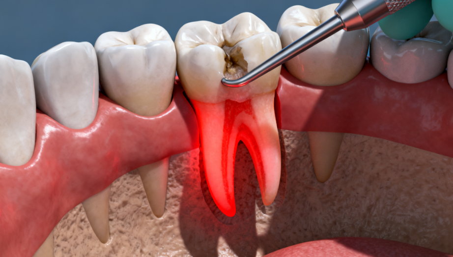 太原拔智齿医院选择建议