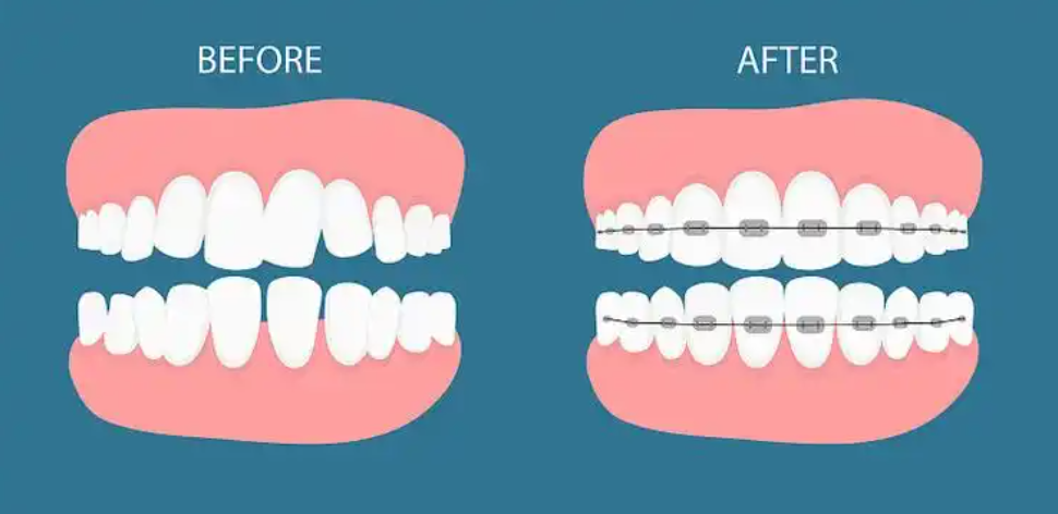 广州中家医口腔是公办医院吗?2025广州私立口腔榜单排名