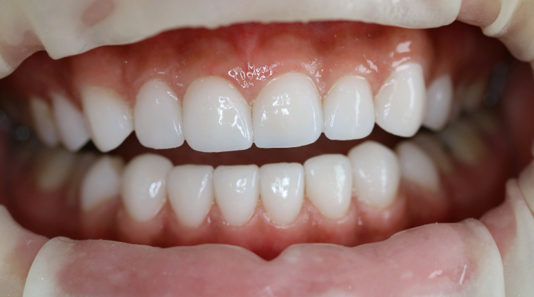 德阳新桥口腔医院特色项目及价格