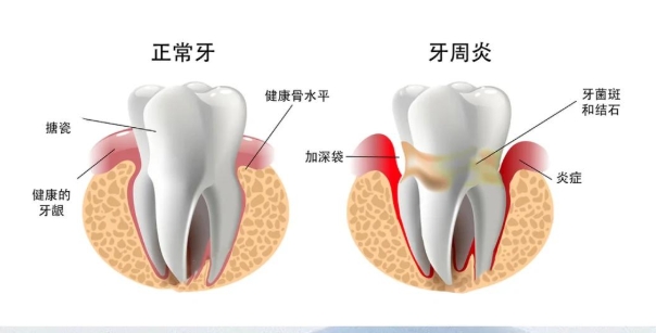 如何选择包头一机口腔医院牙周科医生